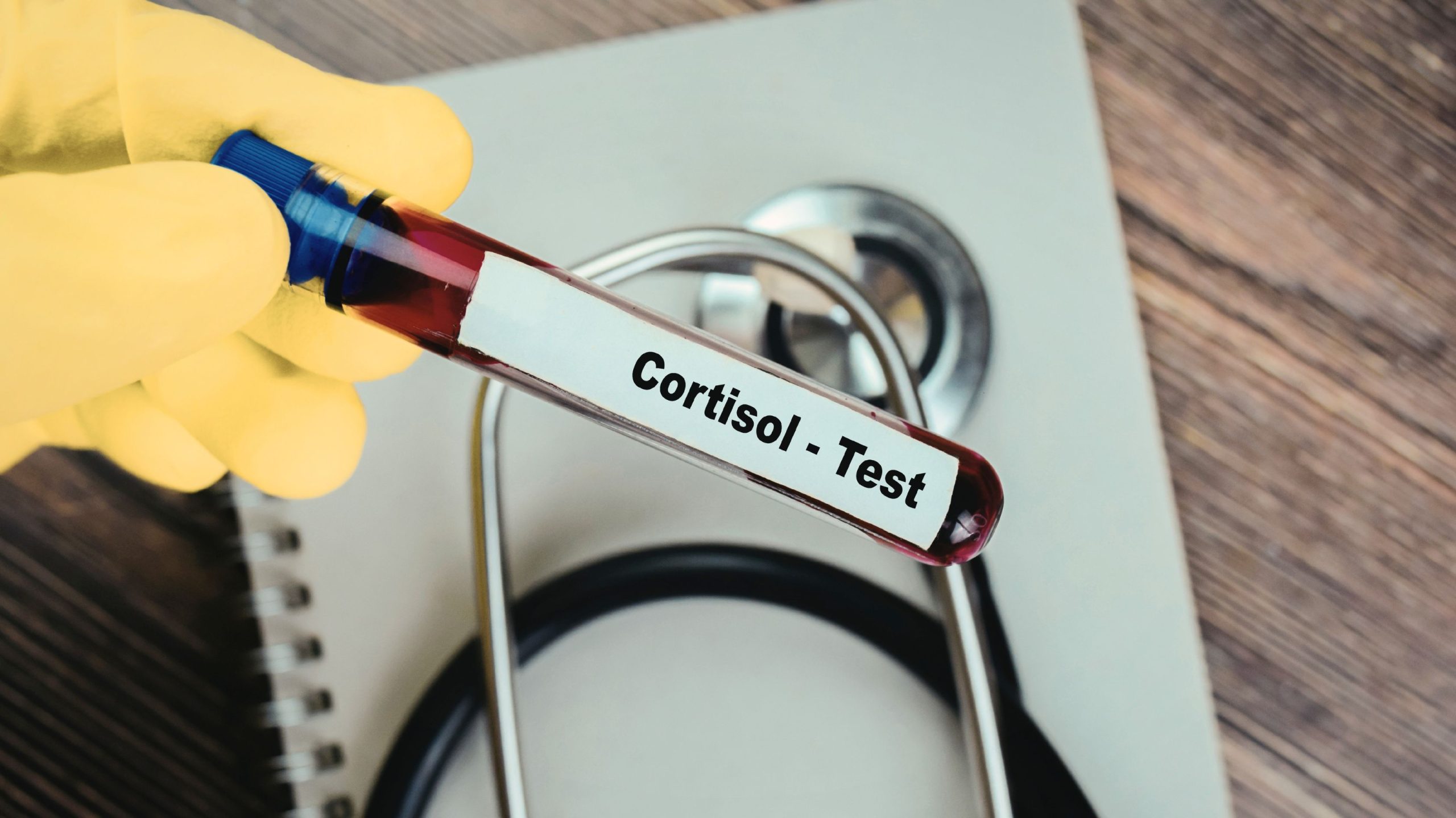 #2: NHỮNG DẤU HIỆU CORTISOL TĂNG MÃN TÍNH – Tiền Đề Của Những Bệnh Nguy Hiểm